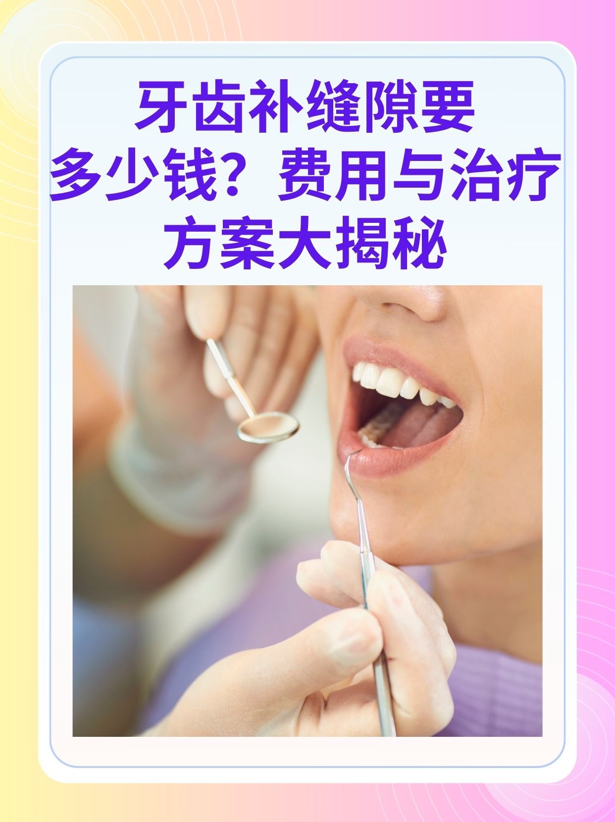 儋州补牙医保可以报销吗(补牙医保可以报销吗 哪些可以报销呢)